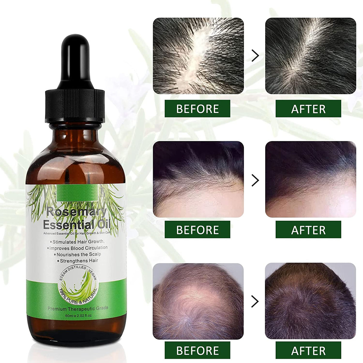 Rosmarinöl Für Haare Und Kopfhaut, Stärkendes Für Gesundes Haarwachstum, 100% Naturreines Ätherisches Rosmarin Öl Für Hautpflege, Aromatherapie