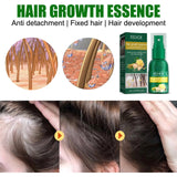 Ginger Hair Growth Spray Products Natural anti Hair Loss Serum Prevent Baldness Treatment Fast Grows Nourish Damaged Hair Care