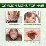 Rosmarinöl Für Haare Und Kopfhaut, Stärkendes Für Gesundes Haarwachstum, 100% Naturreines Ätherisches Rosmarin Öl Für Hautpflege, Aromatherapie